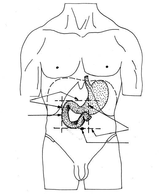 Как определить диастаз мышц - признаки диастаза живота после родов, степень и стадии у мужчин и женщин