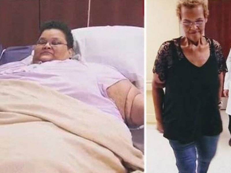 "до и после": как выглядят люди, похудевшие на 150 кг и больше