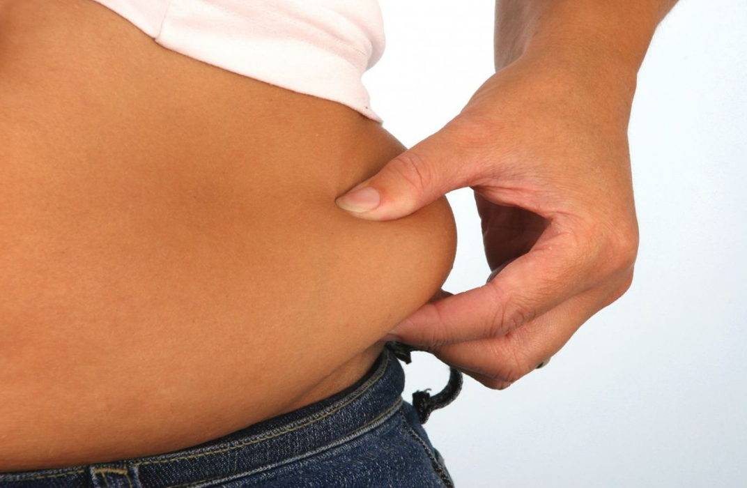 Липедема - это нарушение распределения жировой ткани на бедрах, голенях и тазовом поясе.