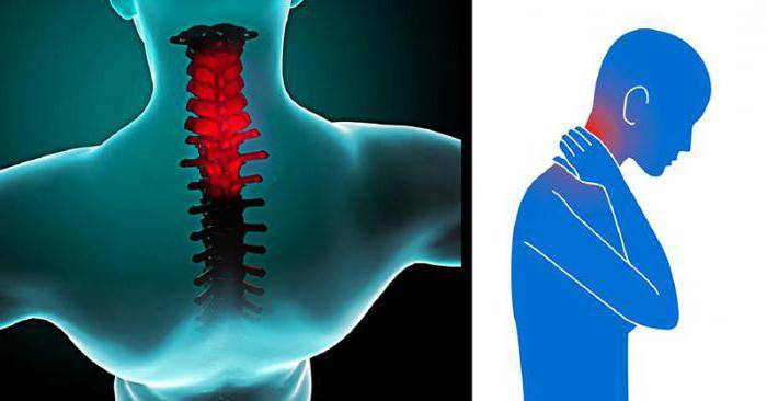 Лечение спазмов мышц спины: первая помощь, методы лечения