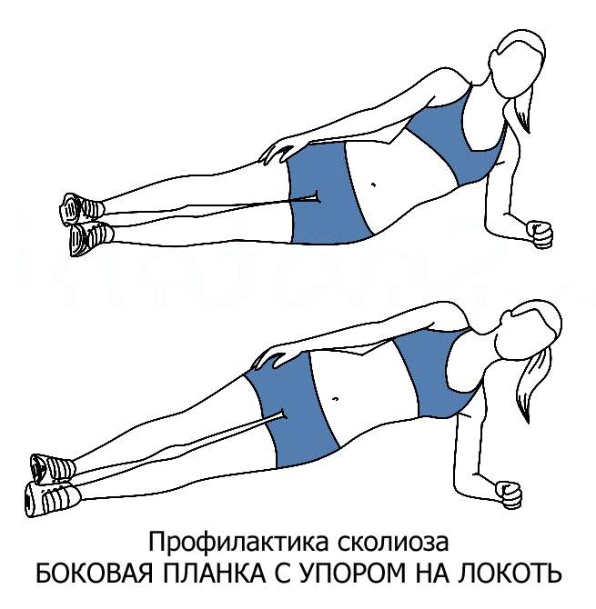 Упражнение "планка" - идеальное тело благодаря одному упражнению