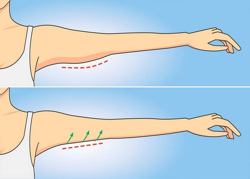 Упражнения для рук, чтобы не висела кожа: как подтянуть трицепс