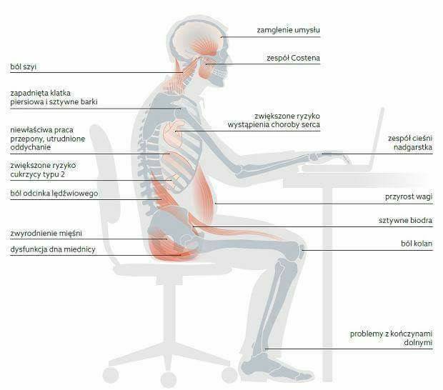 Профилактика варикоза при сидячей работе - «институт вен» лечение варикоза в киеве и харькове