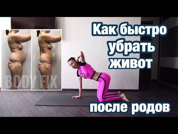 Диастаз прямых мышц живота | форум prof-medicina.ru