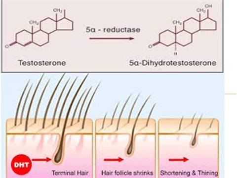 Как снизить чувствительность волос к дигидротестостерону