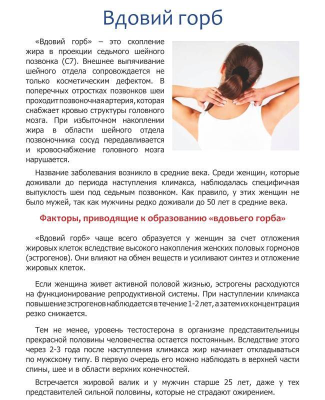 Всего 2 упражнения, которые помогут убрать холку на шее (видео)