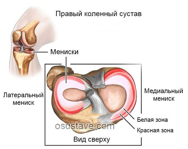 Операция на мениске коленного сустава: послеоперационный период пациента, значение и особенности реабилитации