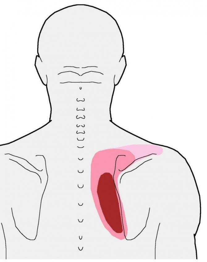 Боль между лопаток в спине | причины, симптомы и методы лечения