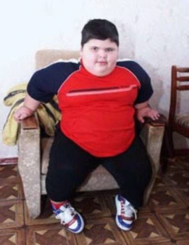«самый толстый малыш в мире» джамбулат хатохов умер в возрасте 21 года, пытаясь похудеть ► последние новости