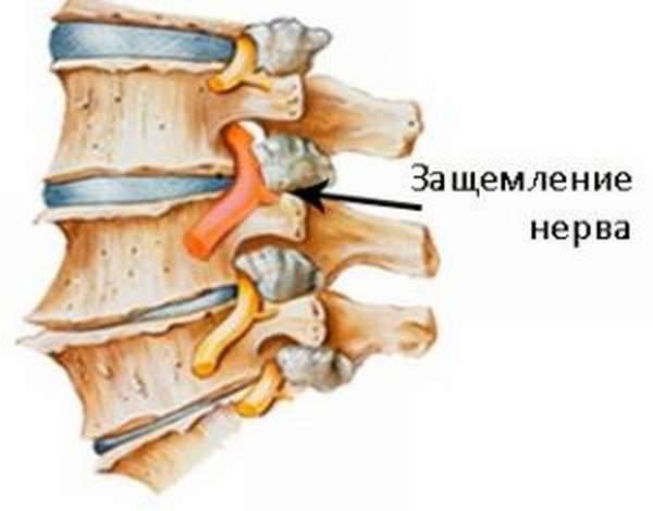 Блокады при болях в позвоночнике: эффективное лечение боли в спине