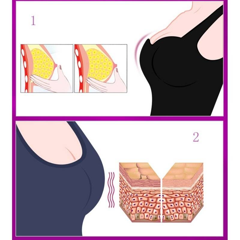 Как уменьшить грудь без операции