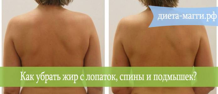 Как убрать жир со спины у женщин: упражнения от жира на спине
