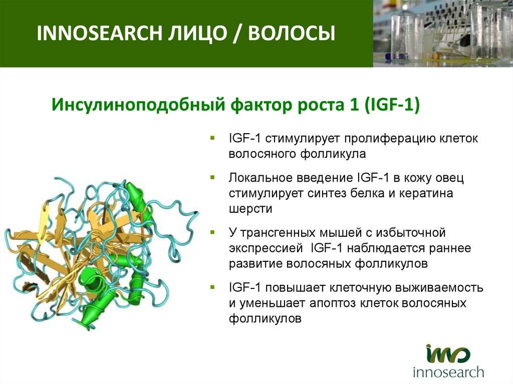 Фактор роста результаты. Инсулиноподобный фактор роста-1 (ИФР-1).. IGF-1 инсулиноподобный фактор роста-1. Инсулиноподобный фактор роста (ИФР-1) норма. IGF инсулиноподобный фактор роста.