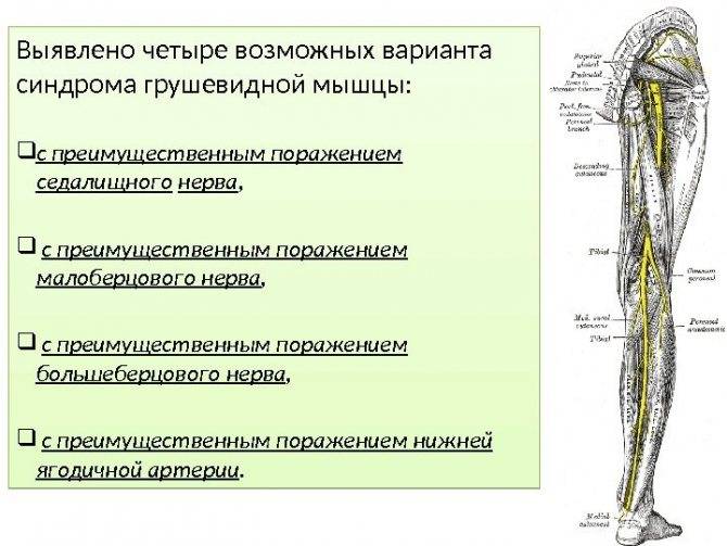 10 упражнений при синдроме грушевидной мышцы | позвоночник.org