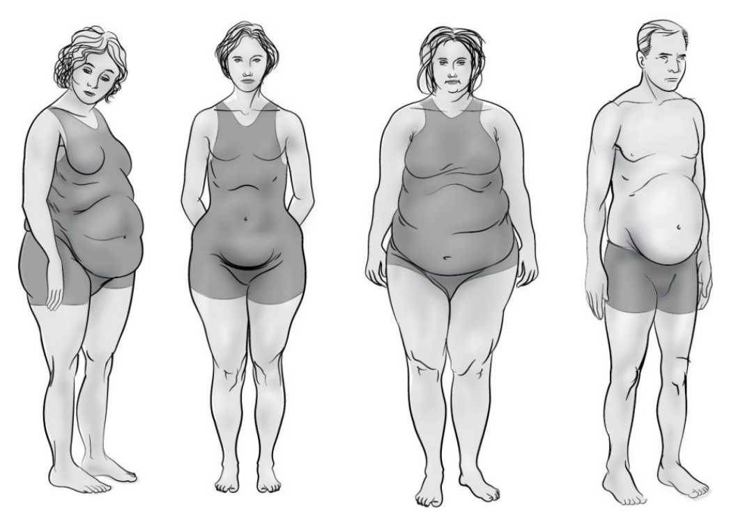 Ожирение – заболевание или распущенность?