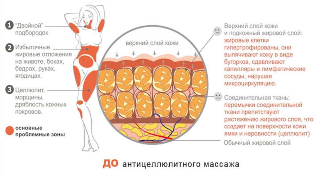 Объясните руководствуясь этой схемой формирование толстого слоя подкожного жира