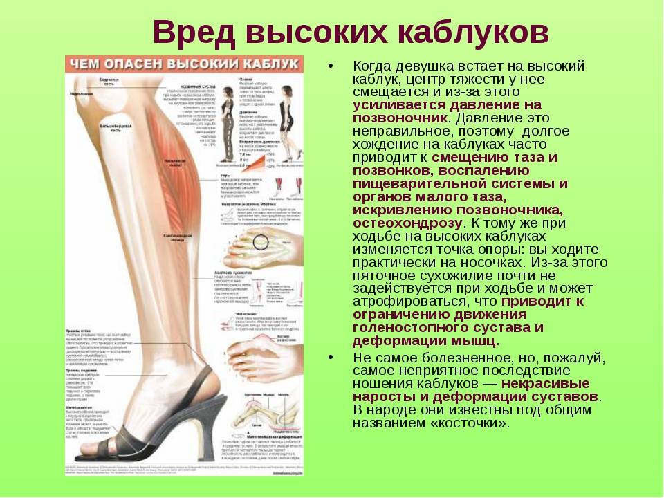 Вред высоких каблуков для здоровья и польза: чем они опасны с точки зрения физики для здоровья женщины, влияние