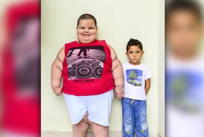 Где живут самые толстые дети в мире | интересный сайт