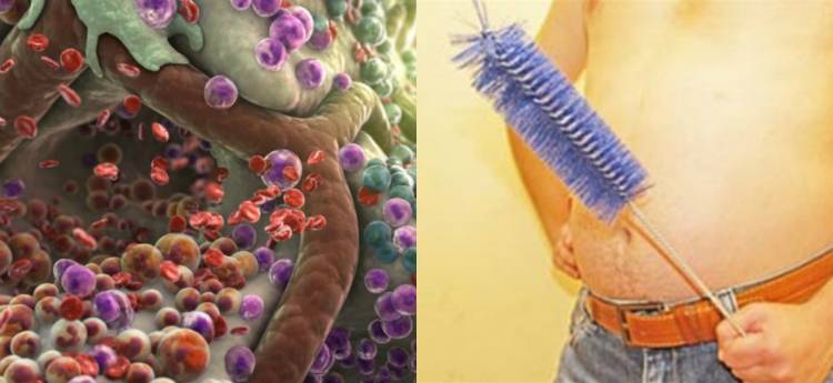 Чистка организма от шлаков и токсинов | компетентно о здоровье на ilive