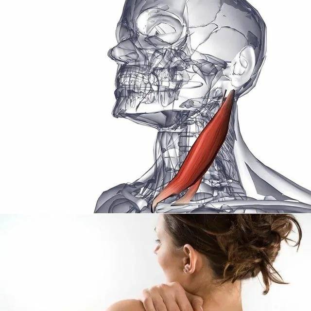 Мышцы шеи: анатомия, как укрепить и накачать шейный отдел