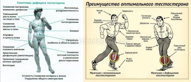 Гипотиреоз: симптомы и лечение