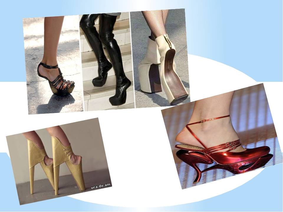 Вред высоких каблуков и последствия для здоровья женщины - статья на mamsy