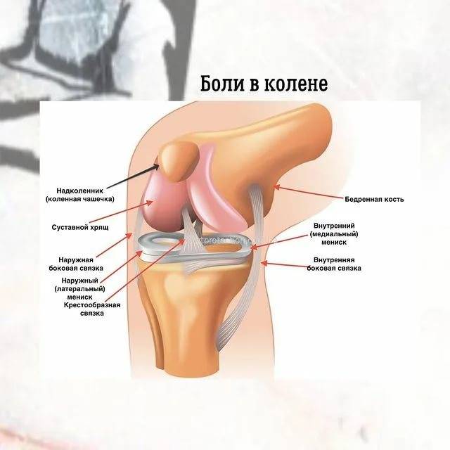 5 секретов восстановления хрящевой ткани в колене - нолтрекс.