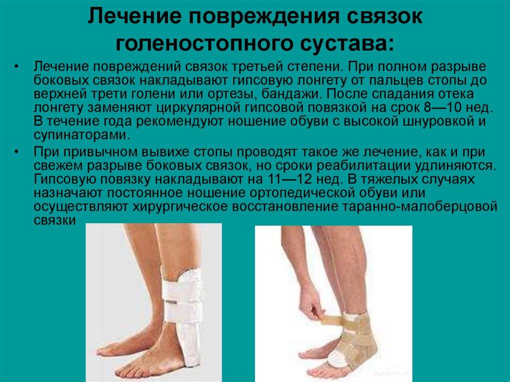 Вывихи, растяжения, разрыв связок: симптомы, лечение, операции