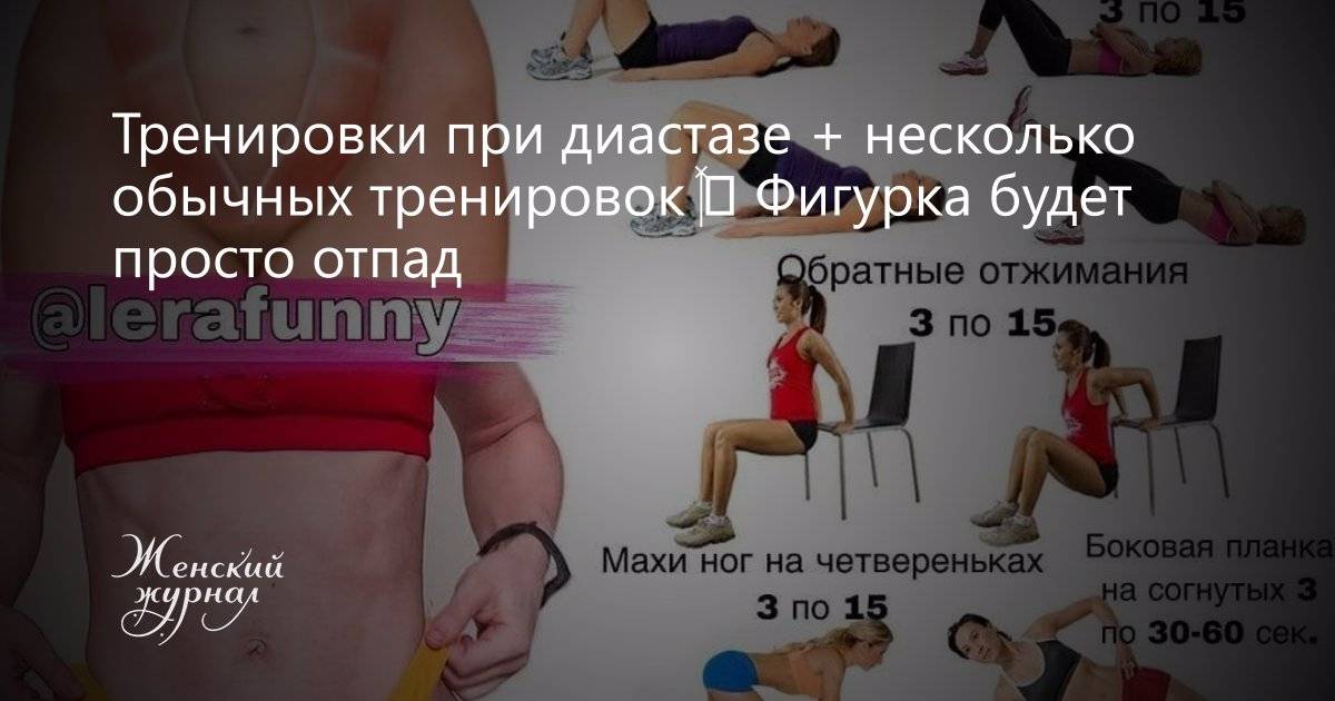 Диастаз упражнения. Упражнения при диастазе. Упражнения при диастазе живота. Упражнения при диастазе мышц живота. Упражнения при диастазе прямых мышц живота.