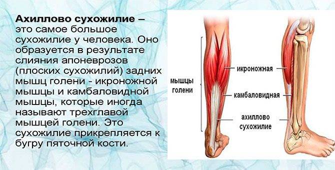 Где находится ахиллесова пята у человека фото признаки и лечение