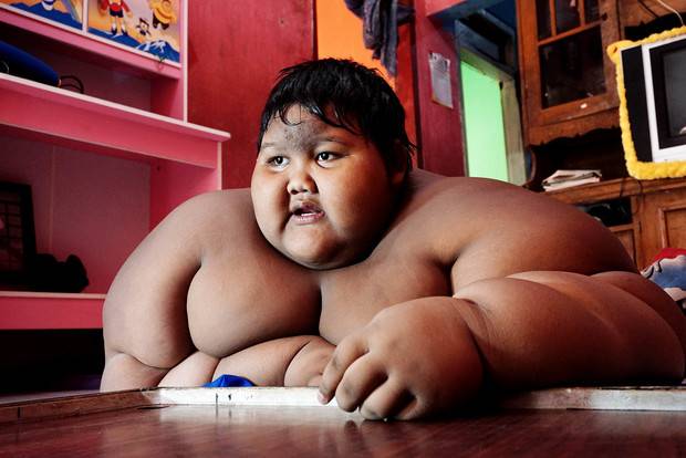 Самый толстый ребенок в мире - фото и история